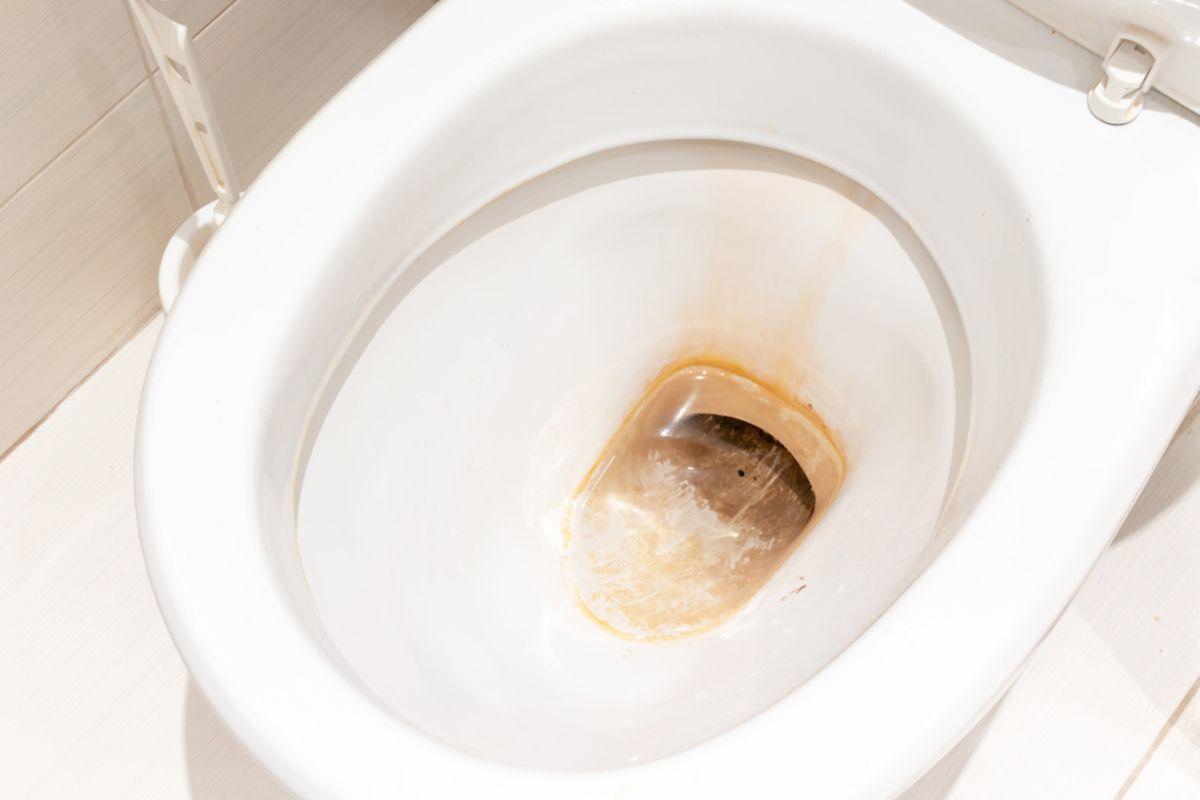 alasan kerak kloset duduk bisa ada